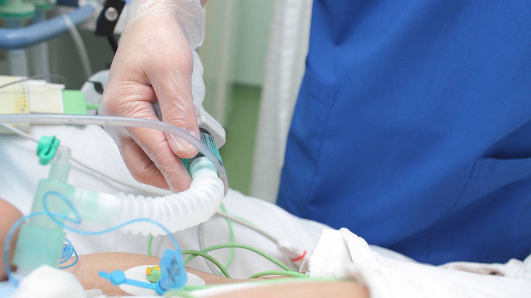 Un paciente puede necesitar ser intubado por diferentes patologías.