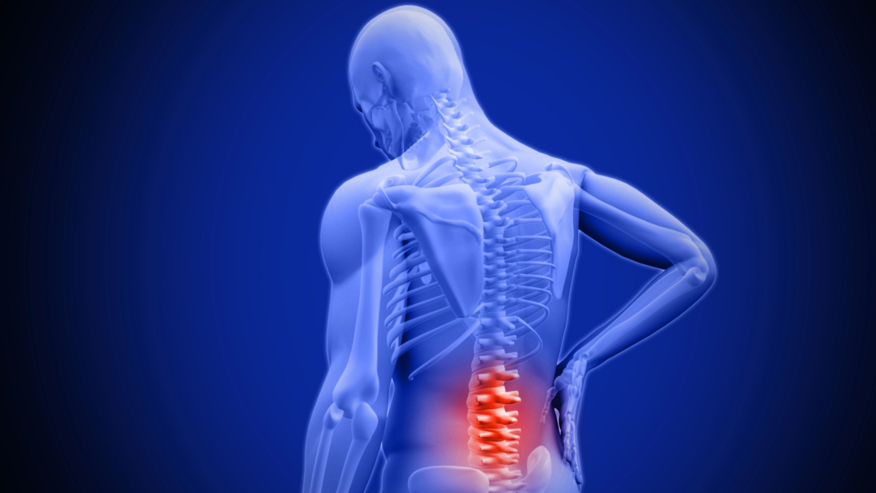 Un nuevo tratamiento logra mitigar el dolor de espalda crónico.