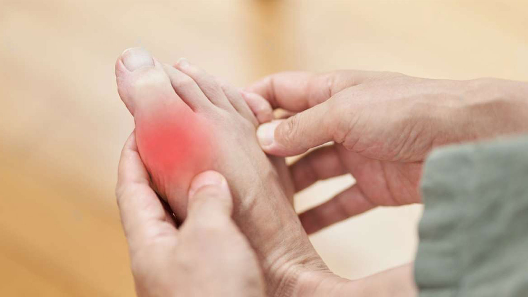 La gota es una de las formas de artritis inflamatoria más frecuentes en todo el mundo.