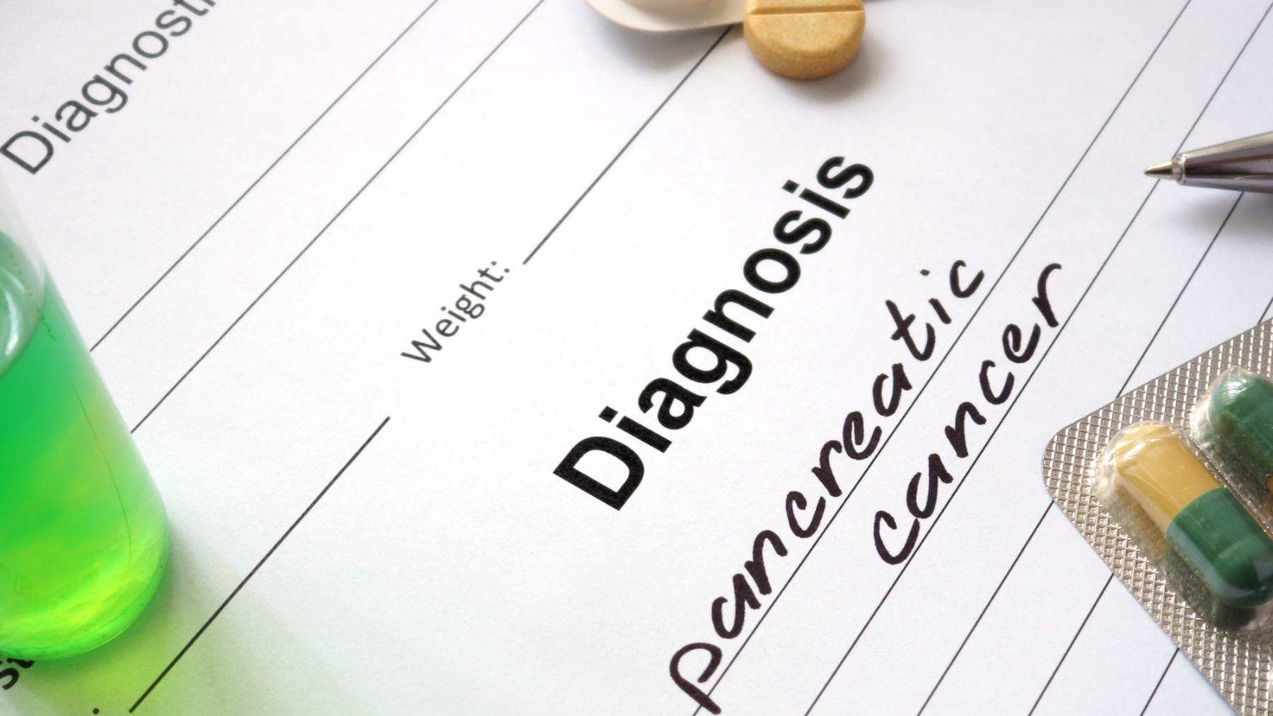 Nueva esperanza para el cáncer de páncreas, pero aún queda camino científico.