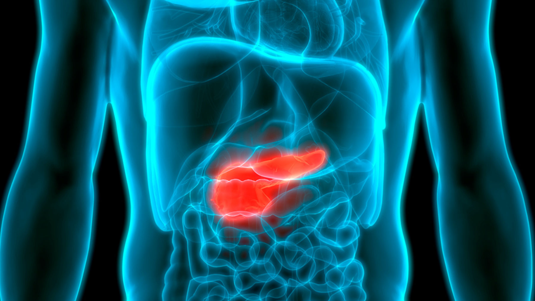 El cáncer de páncreas representa la tercera causa de mortalidad por cáncer.