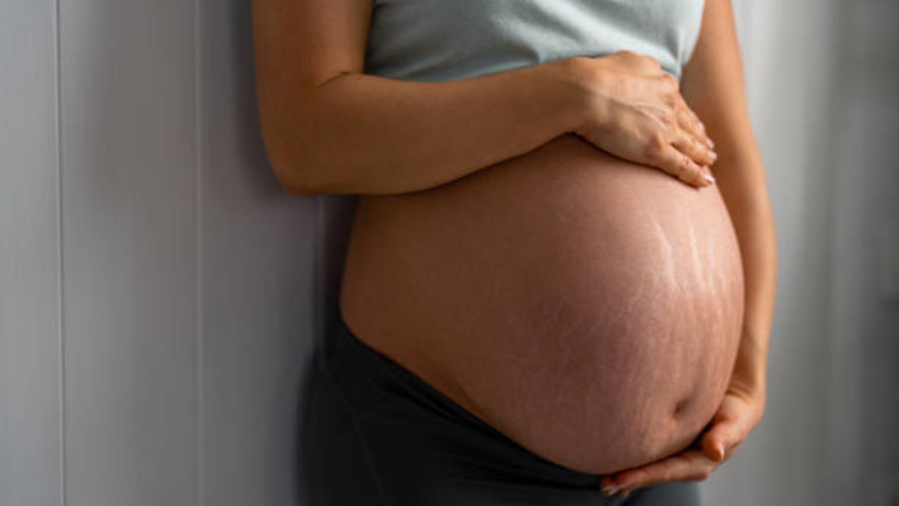 Mujer embarazada con estrías.