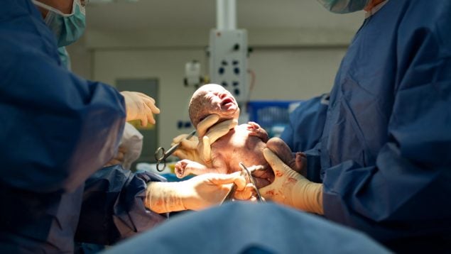 parto epidural
