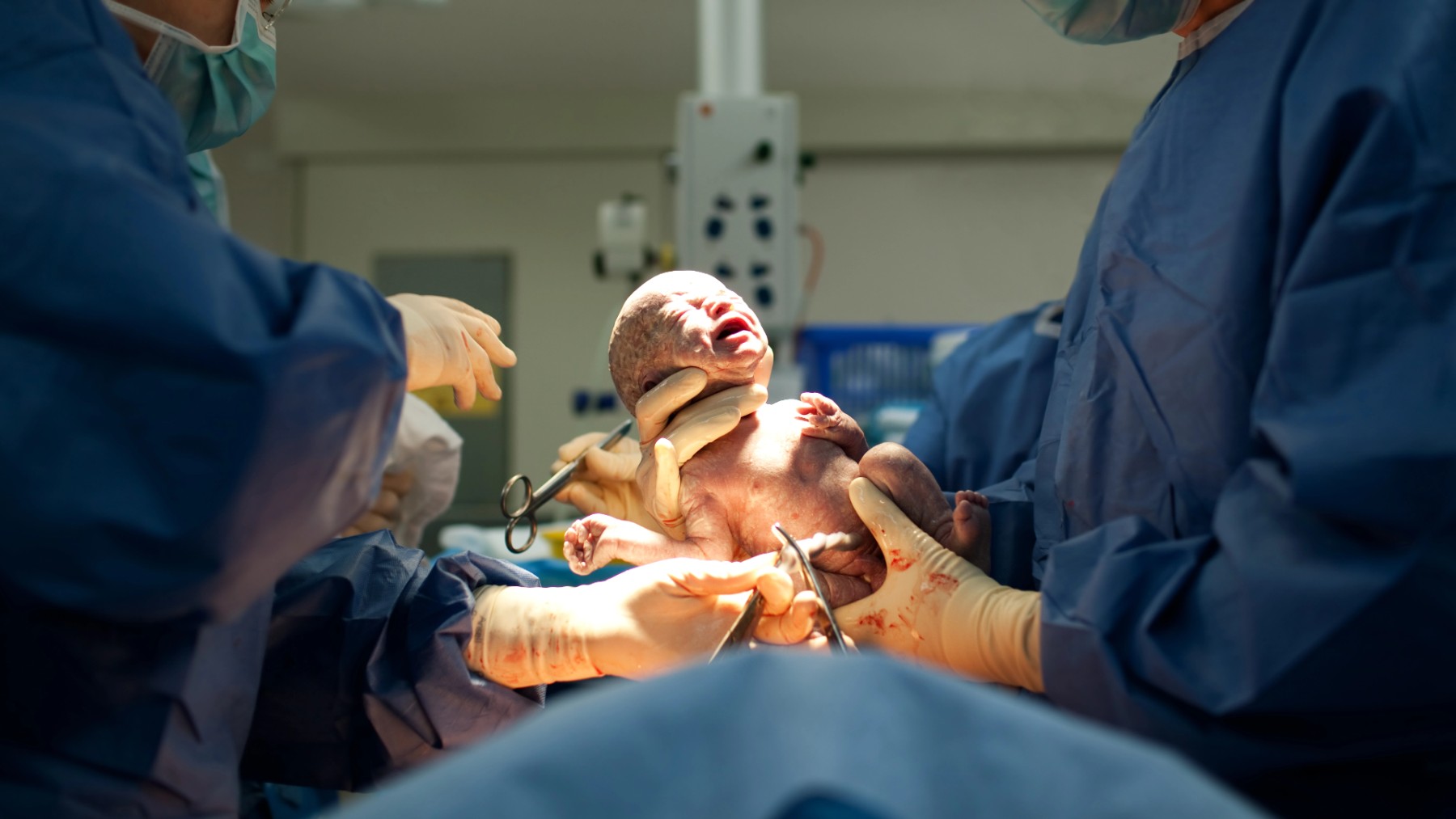 Un equipo médico atiende un parto.