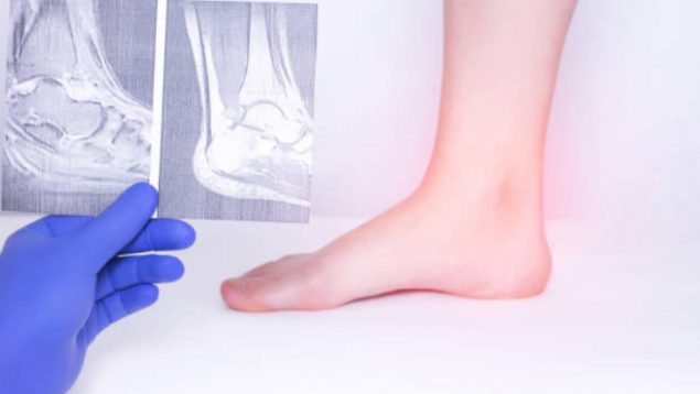 Todo el mundo se pone papel de aluminio en los pies: el motivo que afecta a nuestra salud