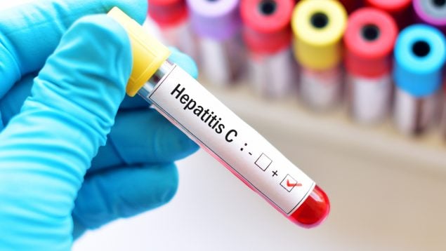 HEPATITIS C