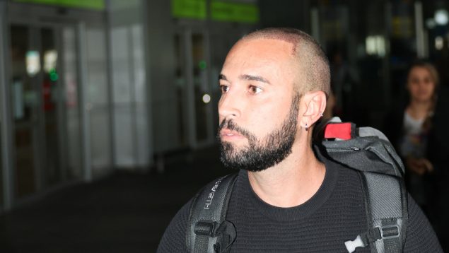 Omar Sánchez después de hacerse un injerto capilar en Madrid