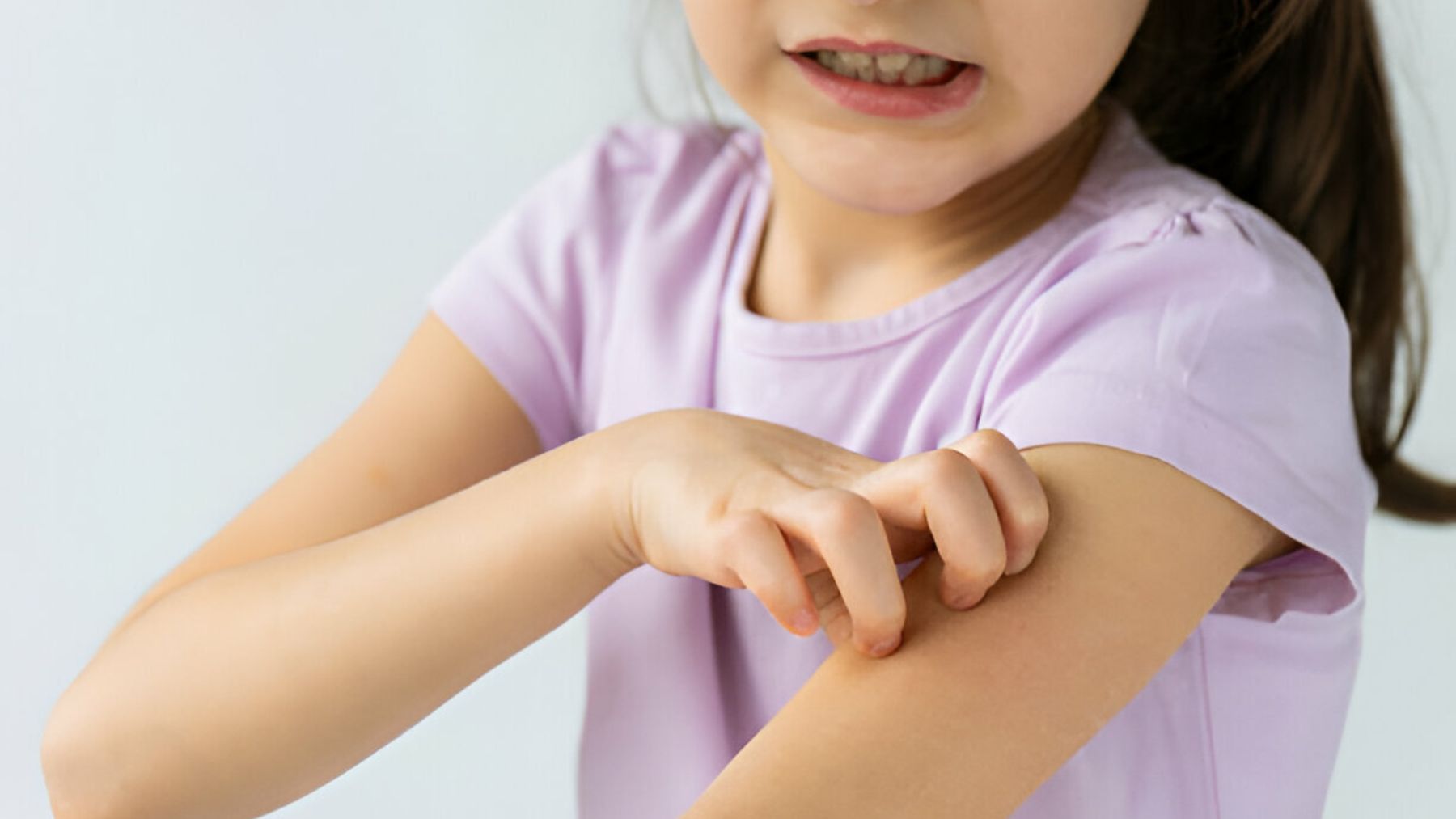 niña que se rasca por tener picor en el brazo.