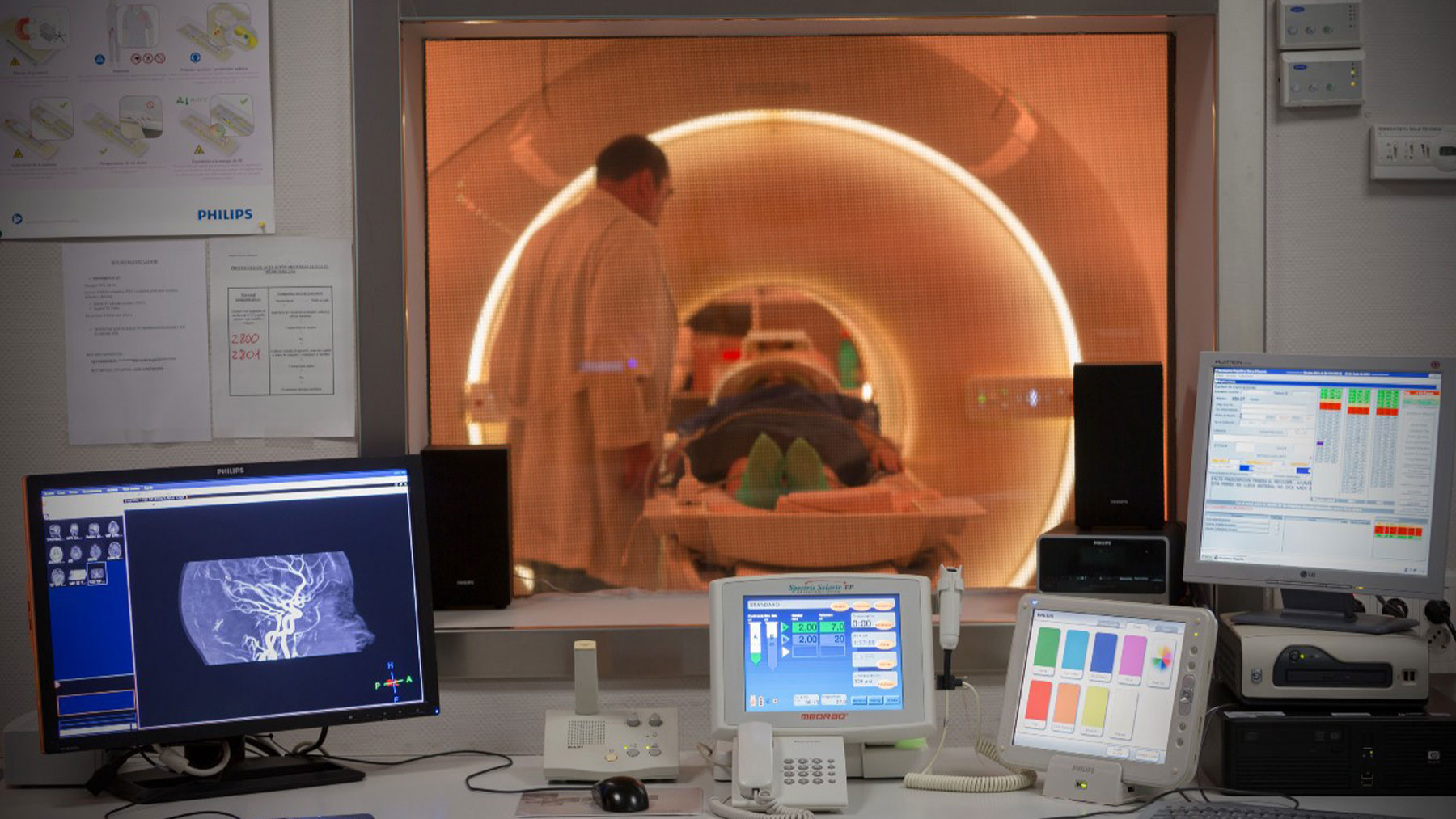 clave en la detección temprana y el manejo individualizado del paciente con cáncer de próstata.