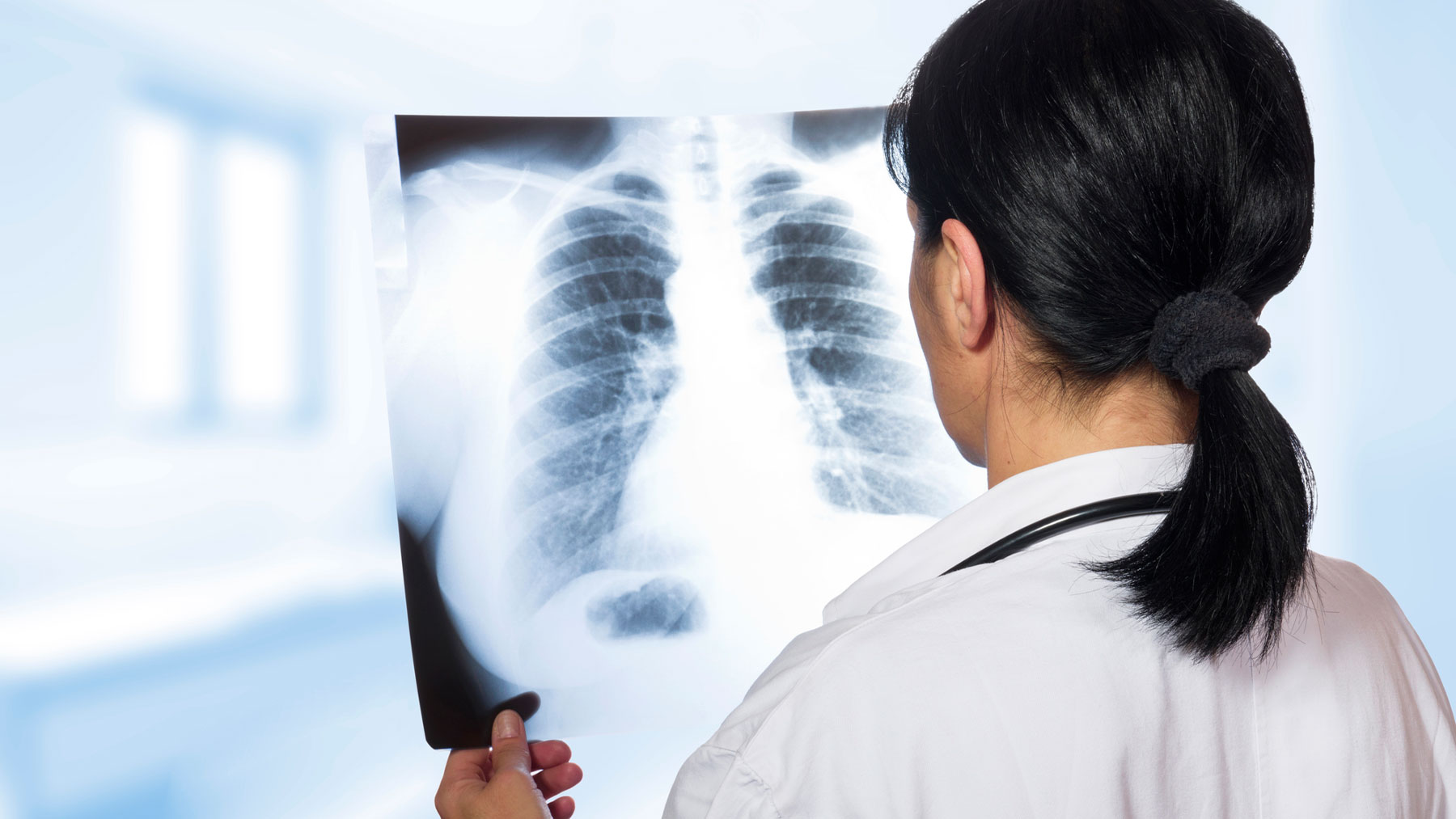 La fibrosis quística afecta, principalmente, a los pulmones.