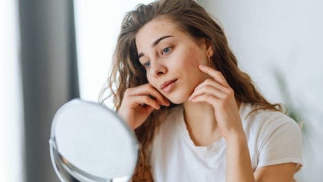 Foto de una mujer joven que se mira al espejo y tiene acné