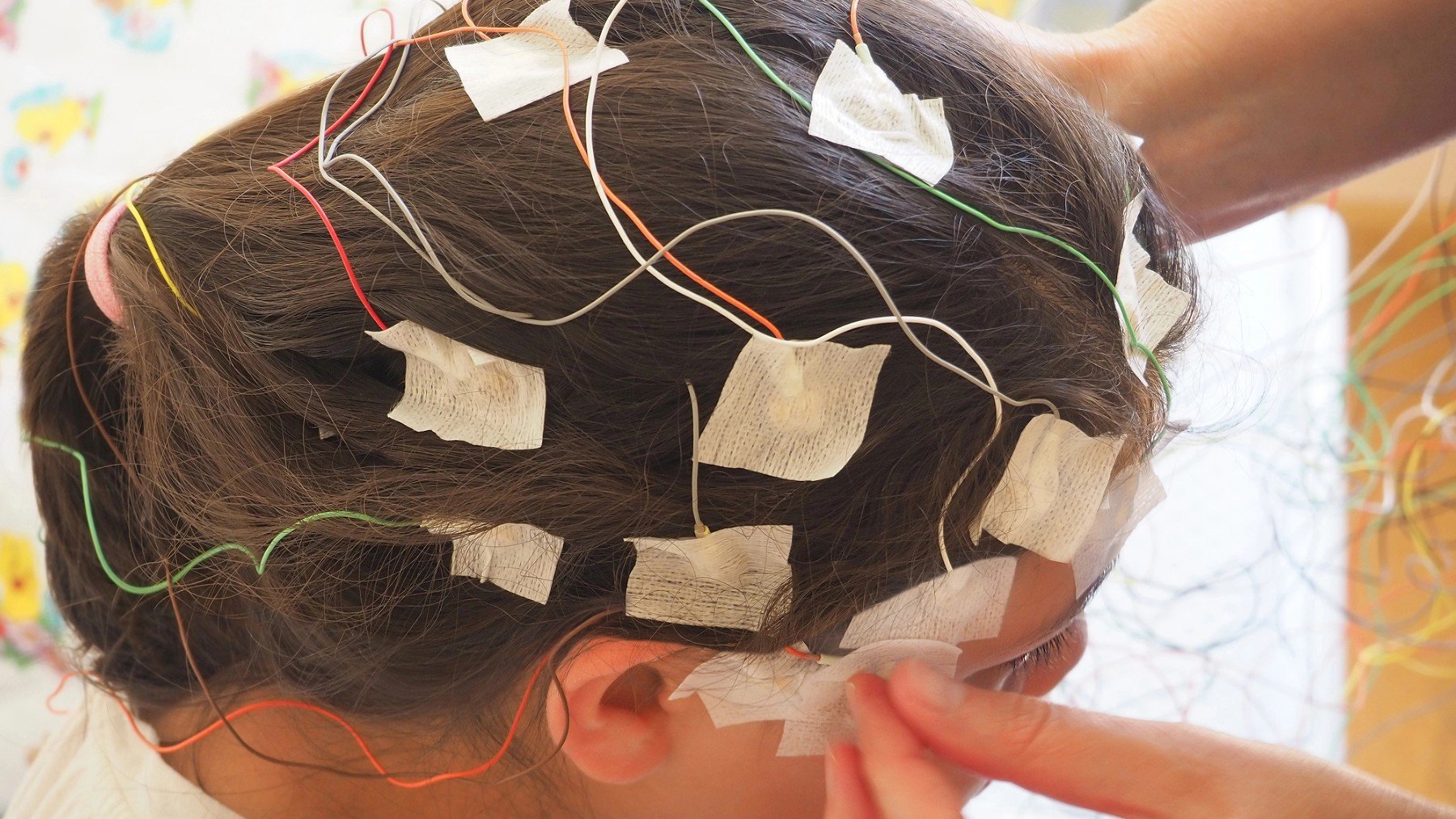 Niña con electrodos.