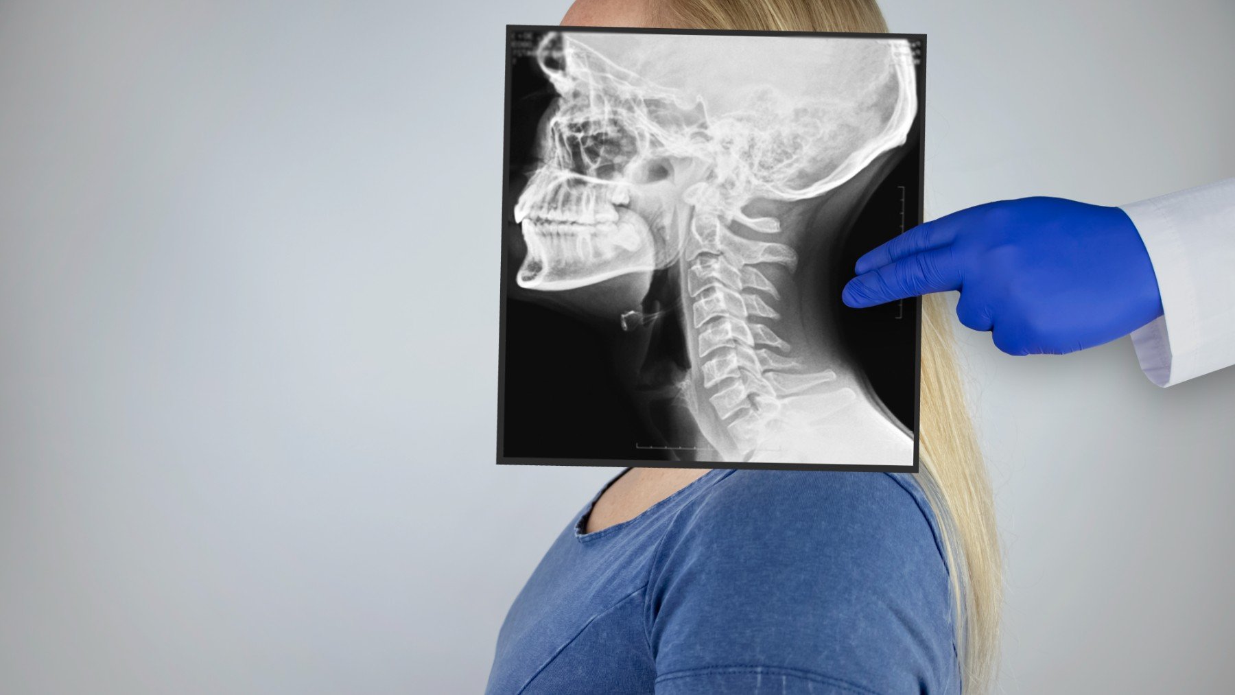 Una mujer con una radiografía de su cabeza y columna vertebral.