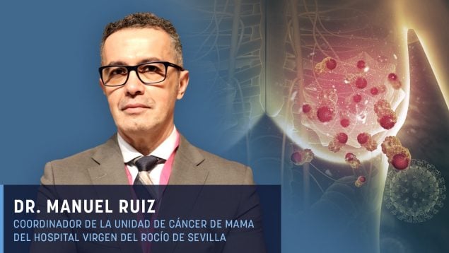 cáncer de mama