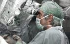 Alzheimer cirugía