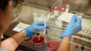 Así es el nuevo análisis de sangre que permite identificar enfermedades genéticas en menos de tres días