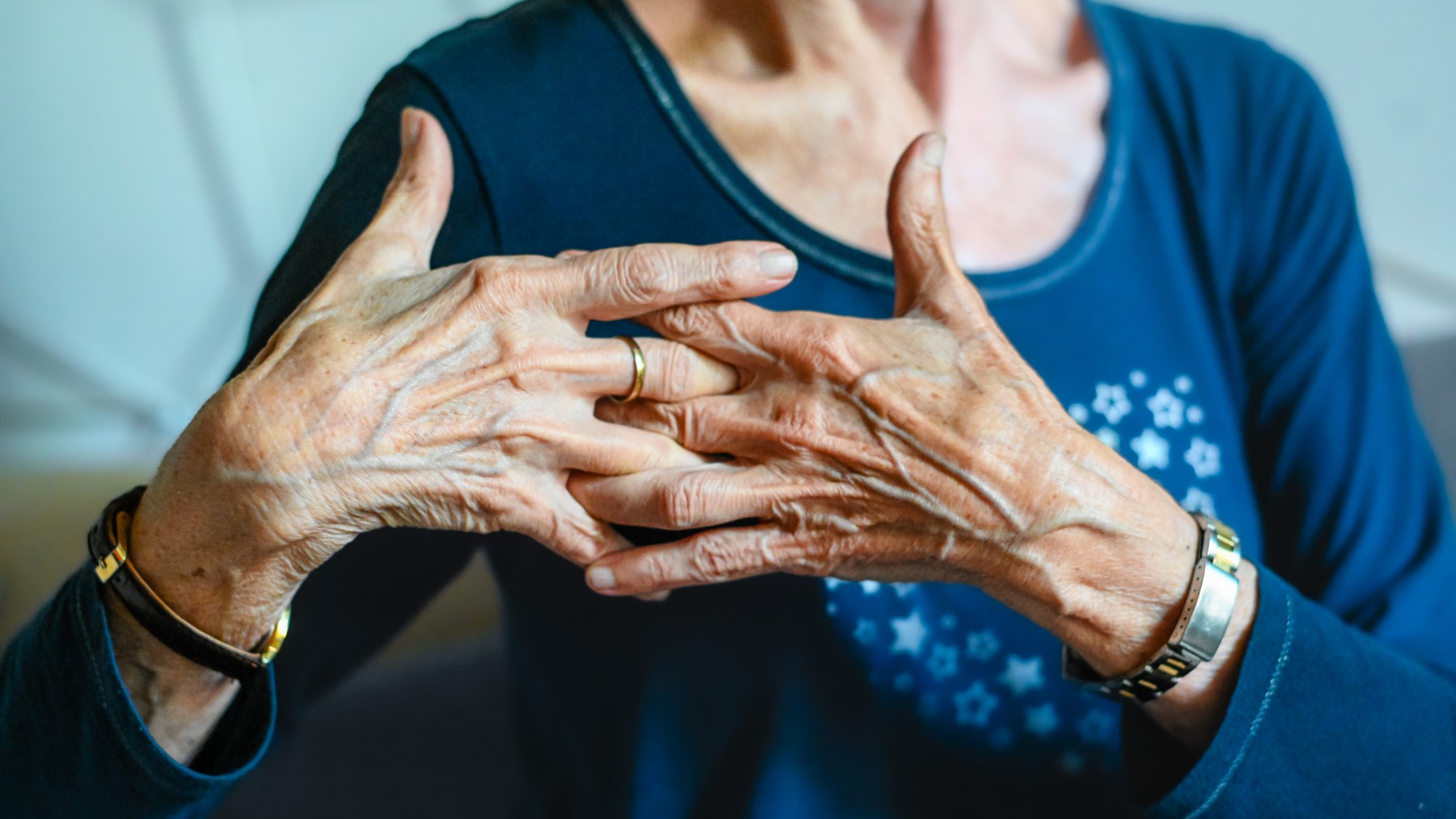 Un caso se artritis psoriática.