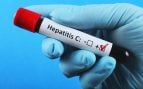 Hepatitis