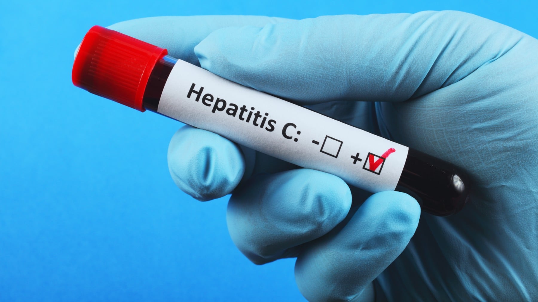 Un nuevo fármaco logra avances históricos contra la hepatitis B crónica: posible curación funcional