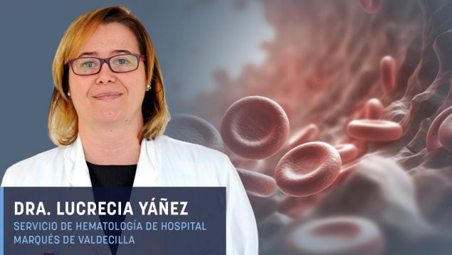 Dra. Yáñez: «Disponemos ya de tratamientos dirigidos frente a la alteración celular de la leucemia»