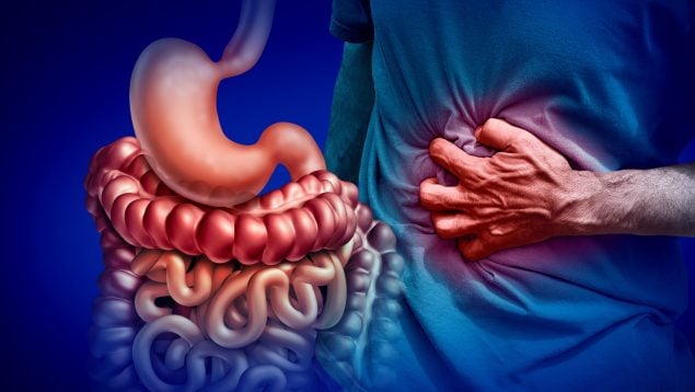 Colitis ulcerosa y Crohn.