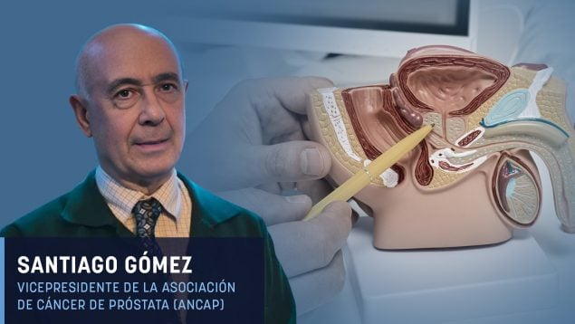 Santiago Gómez: «Sanidad no cubre los tratamientos para los efectos secundarios del cáncer de próstata»