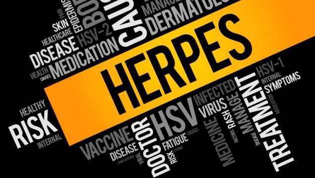 herpes genital