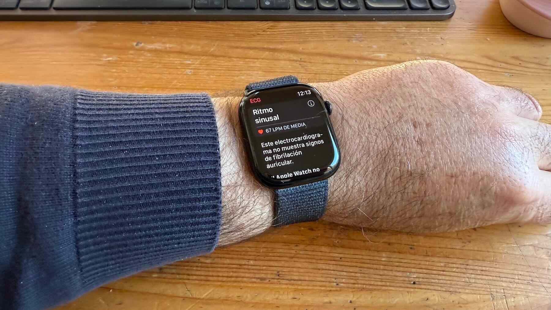 Apple Watch Series 10