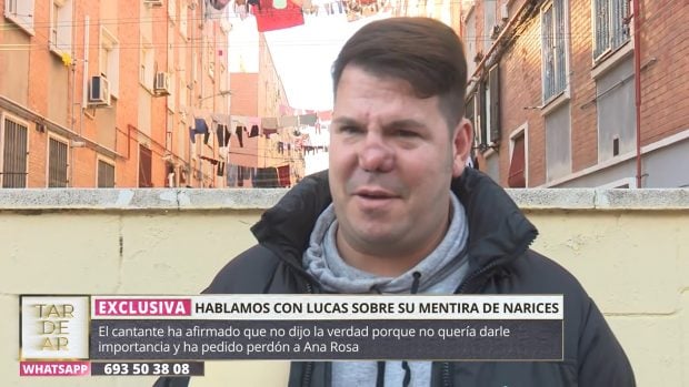 Lucas, de Andy y Lucas, habla con TardeAR para aclarar lo que ocurre con su nariz (Mediaset).