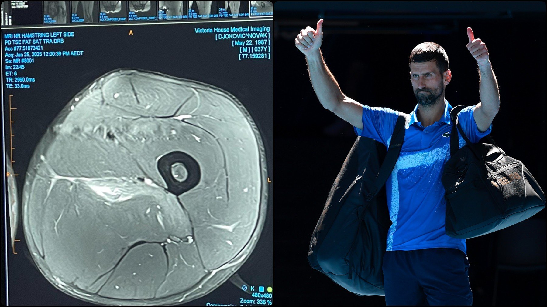 Novak Djokovic muestra una imagen de su resonancia tras la lesión en Australia.