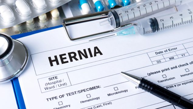 cáncer de mama hernia inguinal