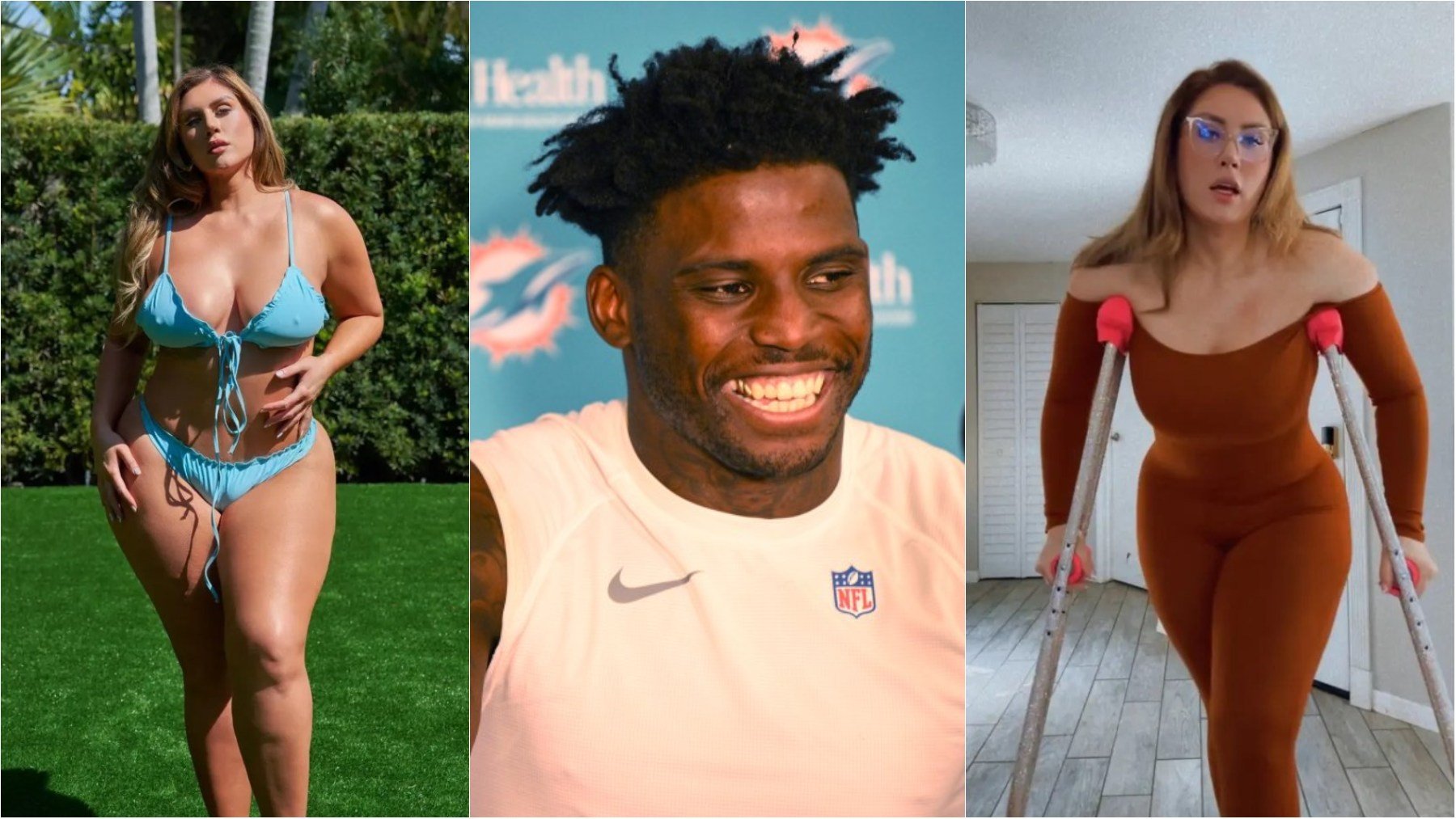 Una modelo de OnlyFans denuncia a un jugador de NFL por partirle la pierna antes de tener sexo