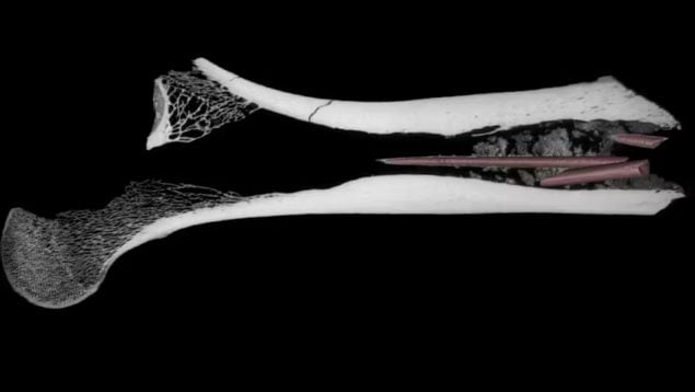 fémur, descubrimientos, tomografía, flechas venenosas