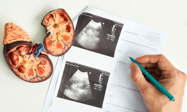 Cirugía robótica y terapias dirigidas: los avances en la lucha contra el cáncer de riñón