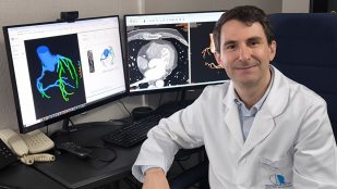 Innovación médica en España: nuevo centro especializado en diagnóstico coronario no invasivo