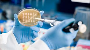 ¿Qué son los organoides y qué aplicaciones tienen en medicina?