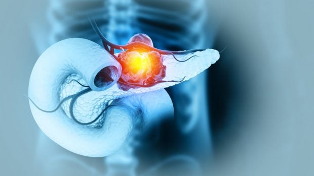 cáncer de páncreas fumar