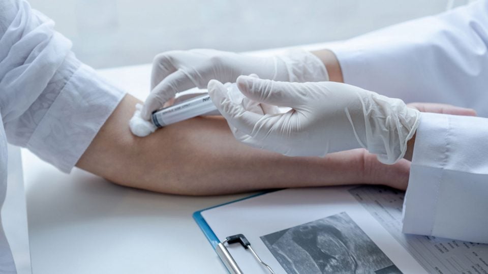 Así es el análisis de sangre que mejora la detección precoz de micrometástasis en cáncer de colon