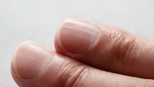 uñas