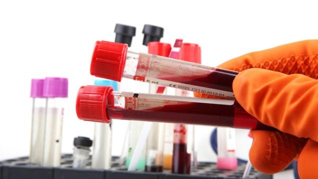 Anemia de Fanconi