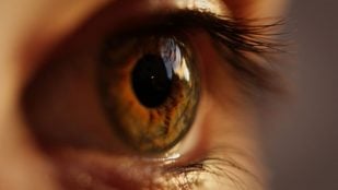 La retina
