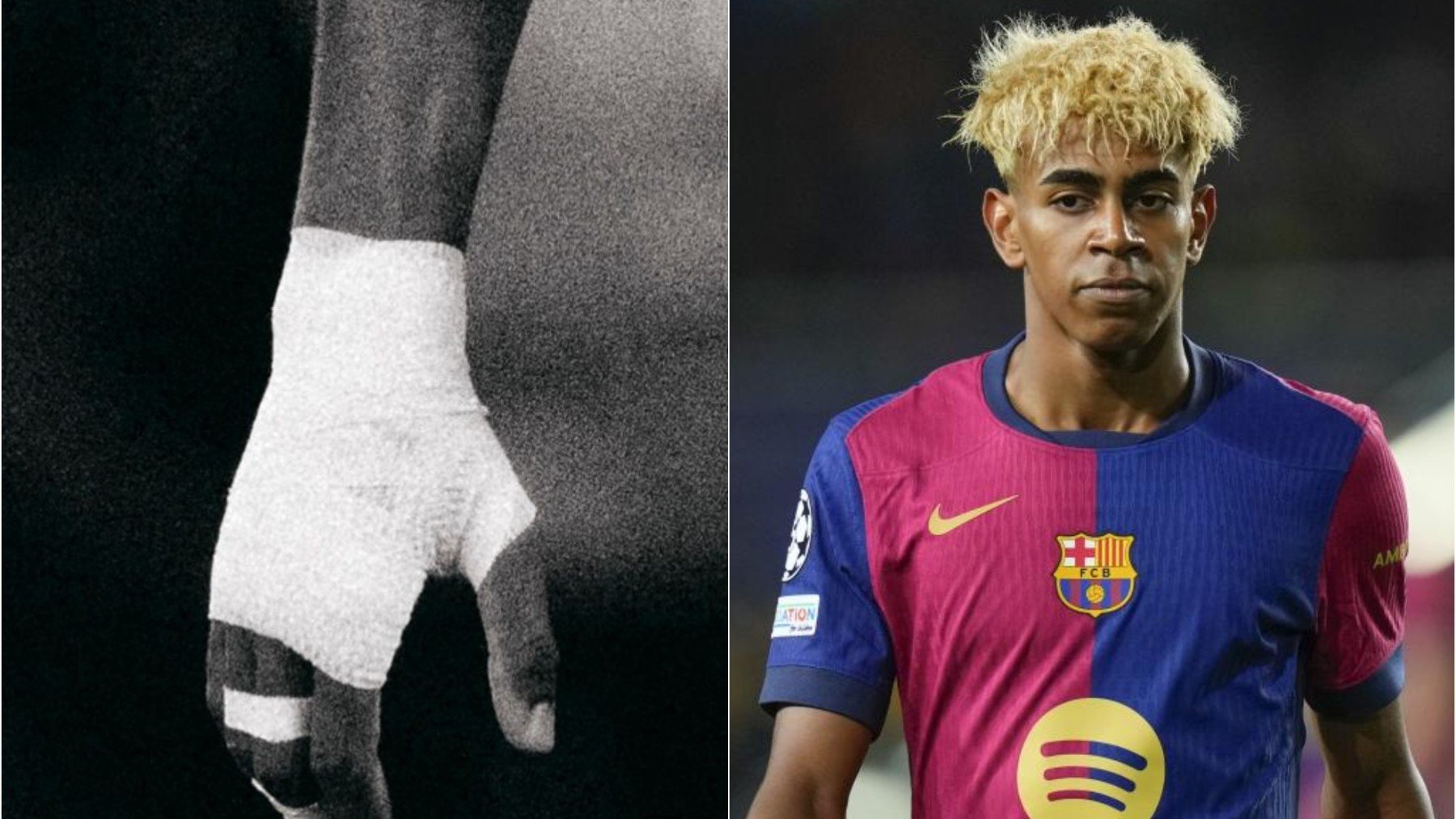 El enigmático mensaje de Lamine para los que sospechan de los vendajes de los jugadores del Barça
