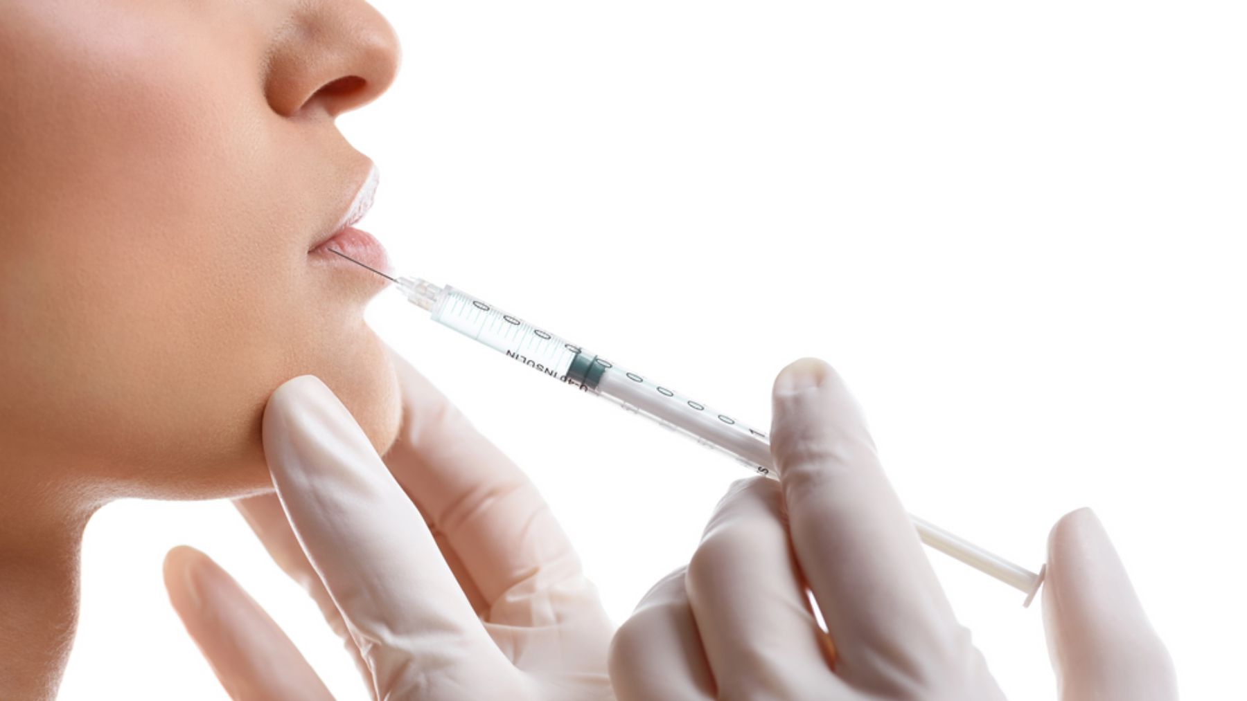El bótox es uno de los tratamientos estrella en medicina estética.
