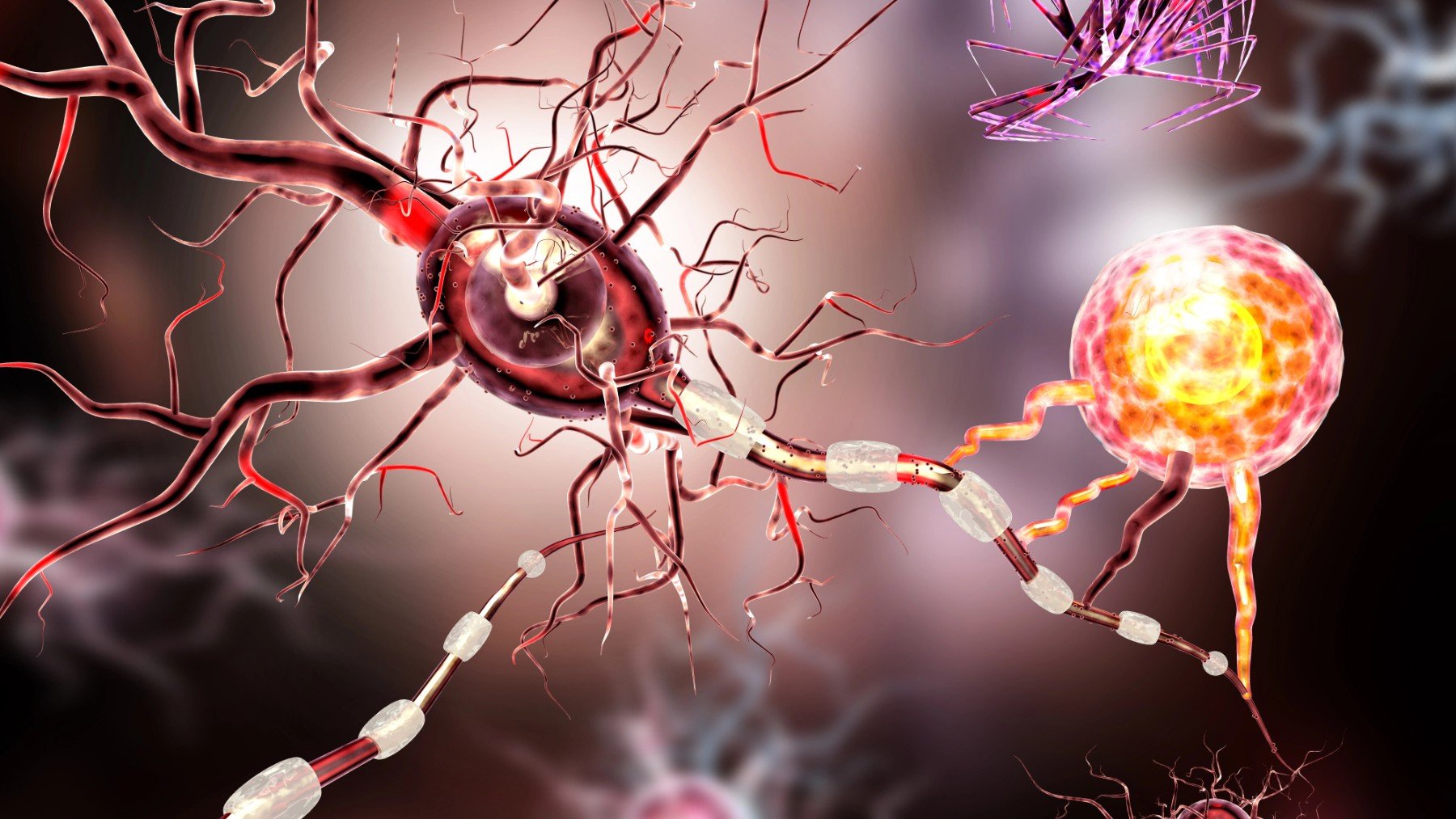 ¿Alzheimer antes de los 30? Un estudio cambia lo que sabemos sobre la enfermedad