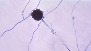 El hongo más peligroso según la OMS, hongos peligrosos para la salud humana, cuál es el hongo más letal según la Organización Mundial de la Salud, hongo aspergillus mortandad.