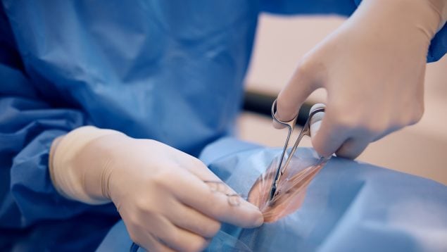 La cirugía mínimamente invasiva es eficaz y segura en el glaucoma de ángulo abierto leve o moderado