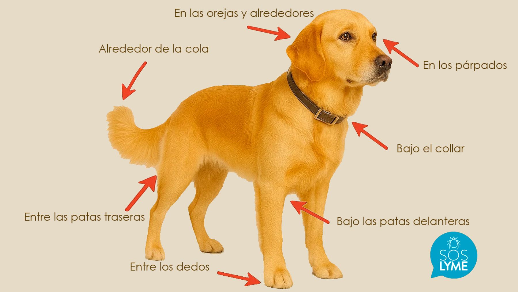 Una infografía que muestra dónde buscar garrapatas.