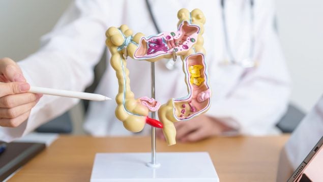 cáncer de apéndice