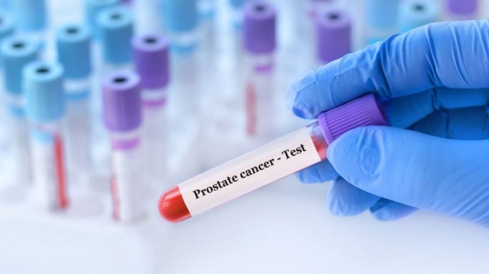 Dolor de huesos en hombres mayores: señal de alarma del cáncer de próstata metastásico