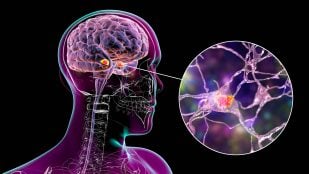 Estimulación cerebral